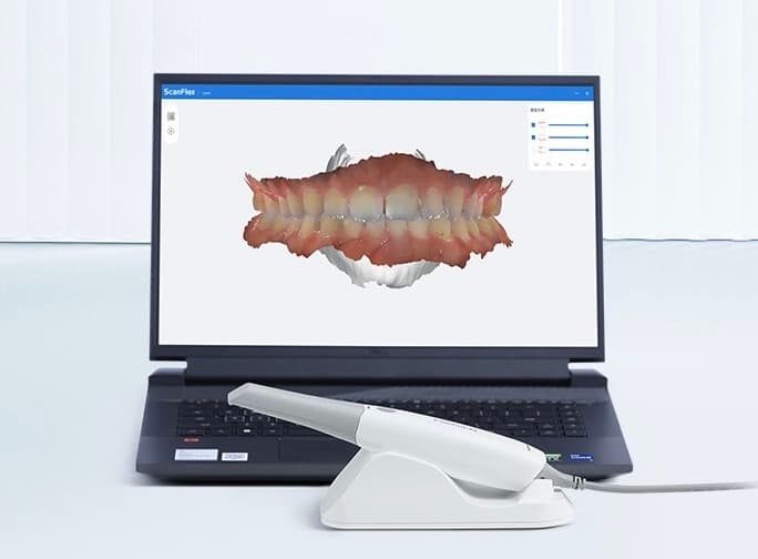 Intraoral Scanner 口内 3D 扫描仪