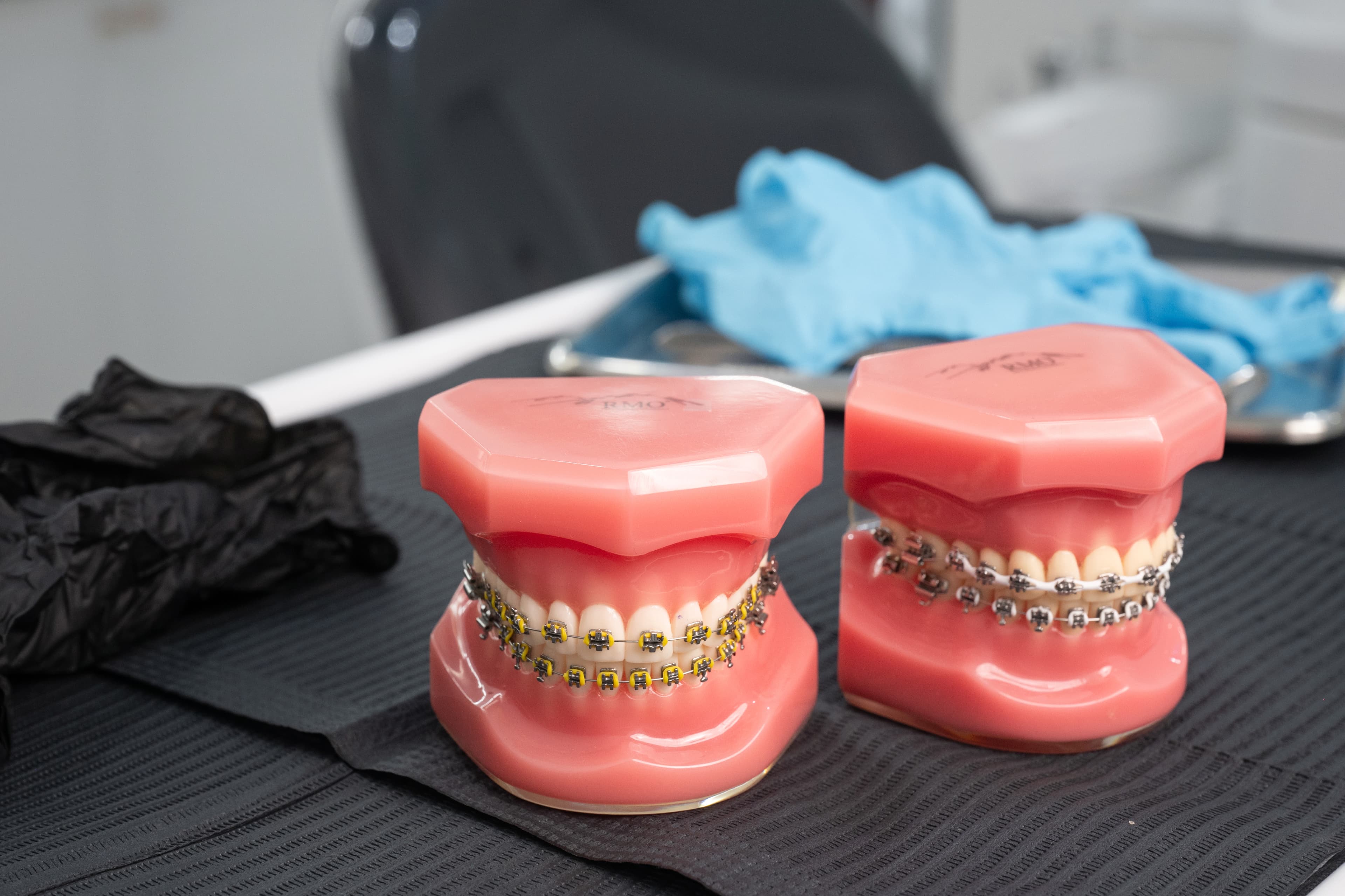 model Metal Braces